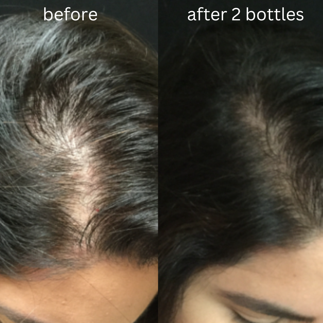 Herbal Organic Hair Oil (For Men & Women)