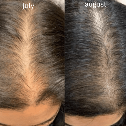 Herbal Organic Hair Oil (For Men & Women)