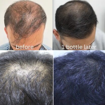 Herbal Organic Hair Oil (For Men & Women)